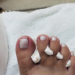 My big toe is bleeding and my little toe is all red.