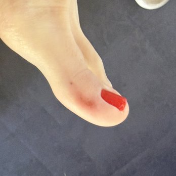 Nail To Toe Rescue - MY BLOODY TOE THEY DID - Nail Salons Near Me - Los Angeles, California