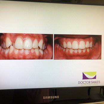 Doctor Smiles Orthodontics - Time for an adjustment - Orthodontists Near Me - Tucson, Arizona Doctor Smiles Orthodontics - Time for an adjustment - Orthodontists Near Me - Tucson, Arizona