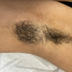 All Jazzed Up - Before underarm waxing