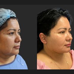 Zamani Plastic Surgery