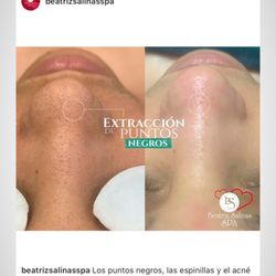 Beatriz Salinas Spa