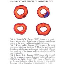 Huo Energy Medicine & Acupuncture NYC - Healing Energy releasing for Dr. Frank Huo's Finger tip captured on Kirlian photos