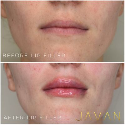 Javan Wellness by null