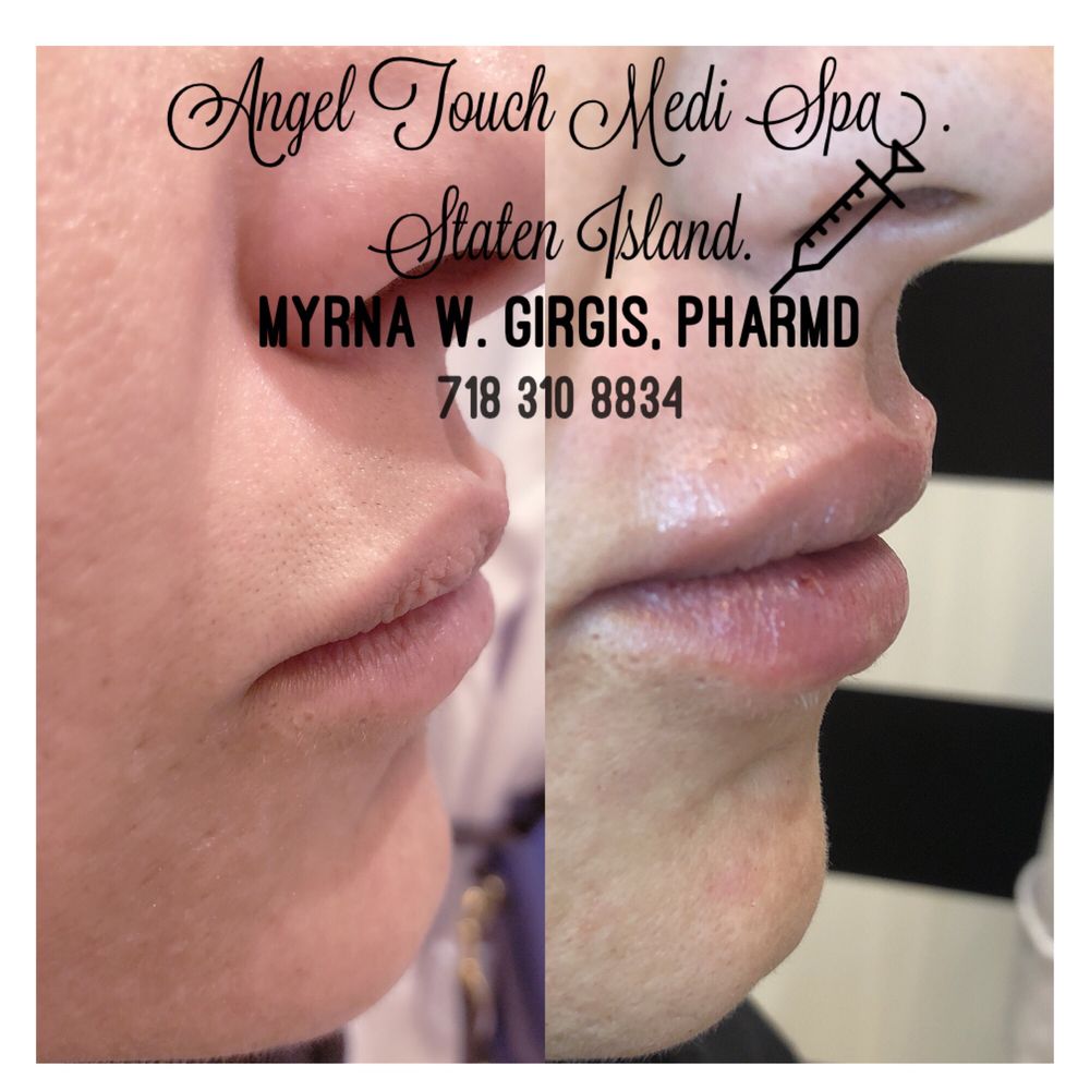 ANGEL TOUCH MEDI SPA STATEN ISLAND Updated October 2024 15 Photos