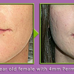 Garrett Harper, MD - Graper Cosmetic Surgery