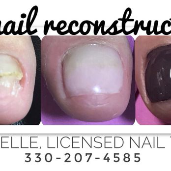Nail Class - Client cleared by doctor prior to service - Nail Salons Near Me - Youngstown, Ohio Nail Class - Client cleared by doctor prior to service - Nail Salons Near Me - Youngstown, Ohio