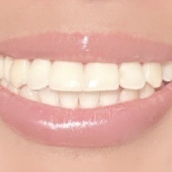 Bella Dental Group - Cosmetic Dentists Near Me - Tustin, California Bella Dental Group - Cosmetic Dentists Near Me - Tustin, California