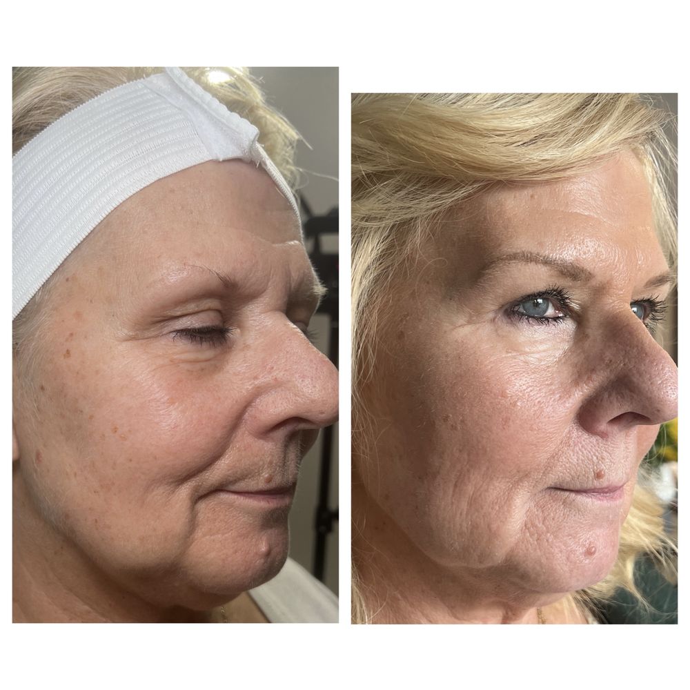 NEXGEN AESTHETICS Updated August 2024 Request an Appointment