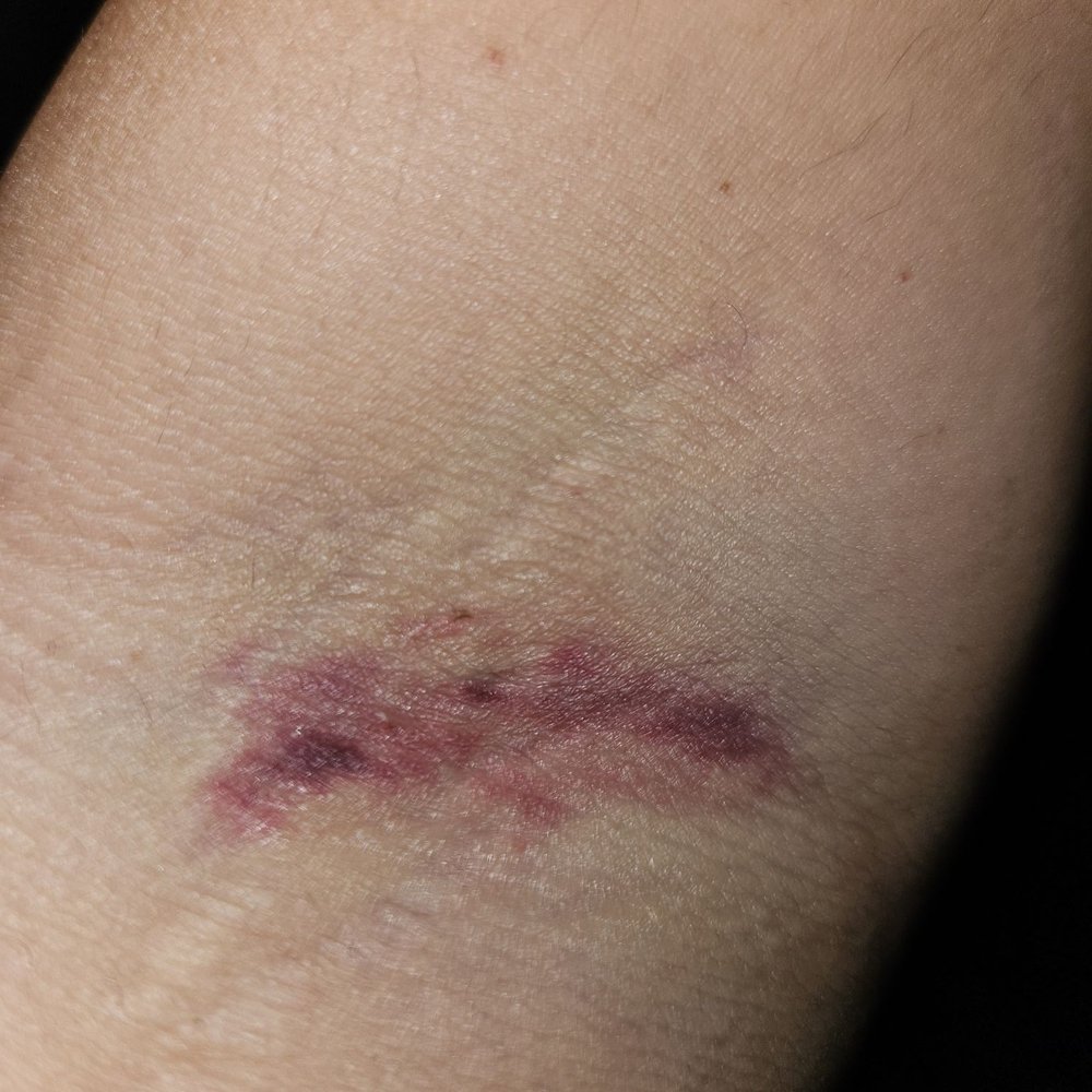 CSL Plasma - A very painful needle job. - Blood & Plasma Donation Centers Near Me - Riverside, California CSL Plasma - A very painful needle job. - Blood & Plasma Donation Centers Near Me - Riverside, California
