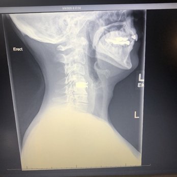 Geisinger Community Medical Center - My disc replacement surgery, performed by "Dr." Darren Jacobs. - Medical Centers Near Me - Scranton, Pennsylvania Geisinger Community Medical Center - My disc replacement surgery, performed by "Dr." Darren Jacobs. - Medical Centers Near Me - Scranton, Pennsylvania