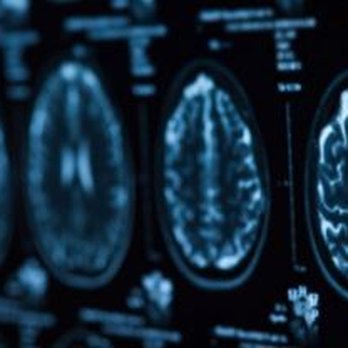 Bertelson Clinic - Neurologist Near Me - Austin, Texas Bertelson Clinic - Neurologist Near Me - Austin, Texas