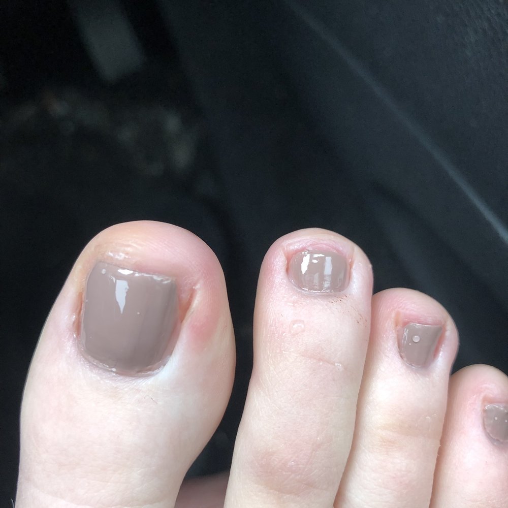 Star Nails & Spa - Toe nails cut sooo short. - Nail Salons Near Me - Des Peres, Missouri Star Nails & Spa - Toe nails cut sooo short. - Nail Salons Near Me - Des Peres, Missouri