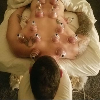 Amy Jens - Cupping is so good for your body!! - Massage Therapy Near Me - Chandler, Arizona