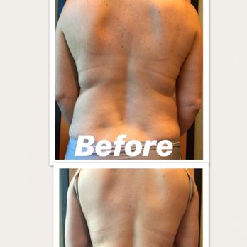 Zen Brazil - Massage Therapy Near Me - Orlando, Florida