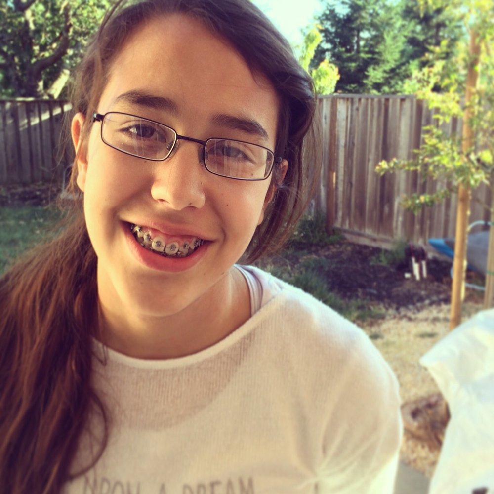 Bernstein Orthodontics - Windsor - New smile - Orthodontists Near Me - Windsor, California Bernstein Orthodontics - Windsor - New smile - Orthodontists Near Me - Windsor, California