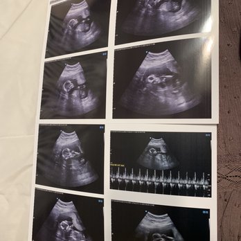 Womb's View - Ultrasound Imaging Centers Near Me - Modesto, California Womb's View - Ultrasound Imaging Centers Near Me - Modesto, California