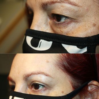 Aesthetic Eye Care - Cosmetic Surgeons Near Me - Paso Robles, California Aesthetic Eye Care - Cosmetic Surgeons Near Me - Paso Robles, California