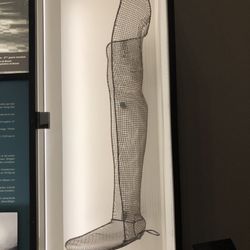 Hospices De Beaune - L'Hotel Dieu - This is what a splint looked like