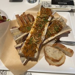 Bone Marrow Bone Marrow