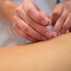 Spirit Rose Wellness - Acupuncture