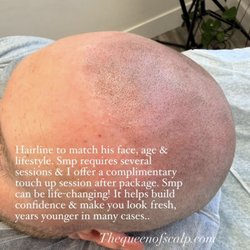 What do you think? Ready for to get your confidence back? His hairline is ready