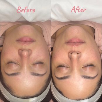 RoyalT Esthetics - Skin Care Near Me RoyalT Esthetics - Skin Care Near Me