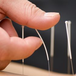 Ehud Udi Tal - Balance Method Acupuncture