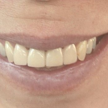 Dr. Ignacio de la Vega - After - General Dentistry Near Me - Tijuana, BCN