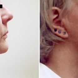 Kelly Plastic Surgery - Toledo, OH Cosmetic Surgery