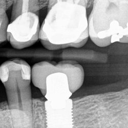 Franco Audia, DDS