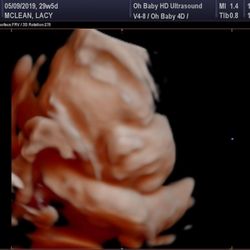 Oh Baby HD Elective 4D Ultrasound Studio