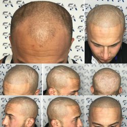 Scalp Allure - Flawless