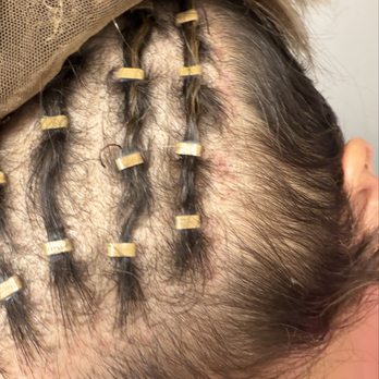 PHD Hair Solutions  - Damage to my scalp two days after adjustment - Hair Loss Centers Near Me - Alpharetta, Georgia