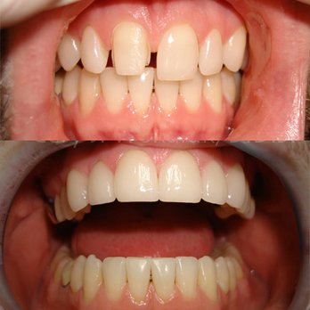 Gary J Wokuluk, DDS - Gary Wokuluk, DDS - El Cajon, CA United States - General Dentistry Near Me - El Cajon, California