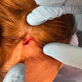 St Timothy Urgent Care - head vs. metal pole - Urgent Care Near Me - Odessa, Florida St Timothy Urgent Care - head vs. metal pole - Urgent Care Near Me - Odessa, Florida