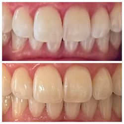 She sent me this before and after image.