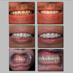Nina Basti, DDS - Smile Makeover!
