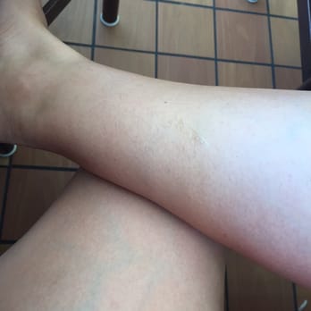 Blown Away - The huge section she missed on my leg! (My hair is quite fair so it's hard to see, but it's quite a large area!) - Eyelash Service Near Me - Seattle, Washington Blown Away - The huge section she missed on my leg! (My hair is quite fair so it's hard to see, but it's quite a large area!) - Eyelash Service Near Me - Seattle, Washington