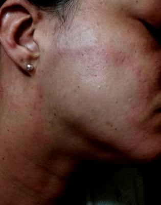 DERMATOLOGY ASSOCIATES OF GEORGIA - Updated August 2024 - 83 Reviews