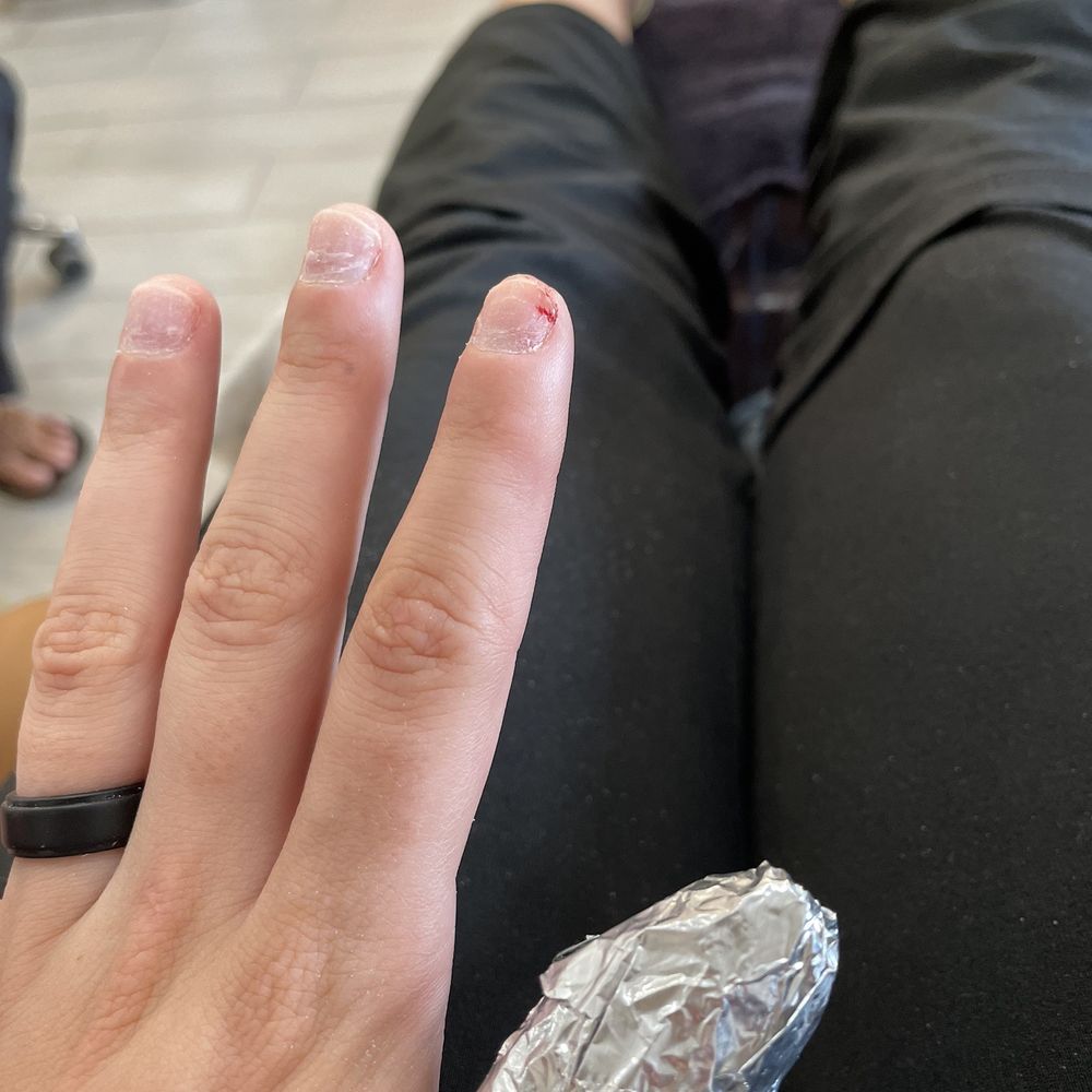 Allure Nails Spa - Left in tears from the literal pain of every acrylic nail being tore off my Jenny. She was rude aggressive and unsanitary. - Nail Salons Near Me - Easton, Maryland Allure Nails Spa - Left in tears from the literal pain of every acrylic nail being tore off my Jenny. She was rude aggressive and unsanitary. - Nail Salons Near Me - Easton, Maryland