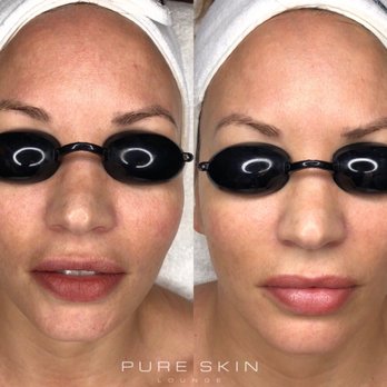 Pure Skin Lounge - Skin Care Near Me - San Diego, California Pure Skin Lounge - Skin Care Near Me - San Diego, California