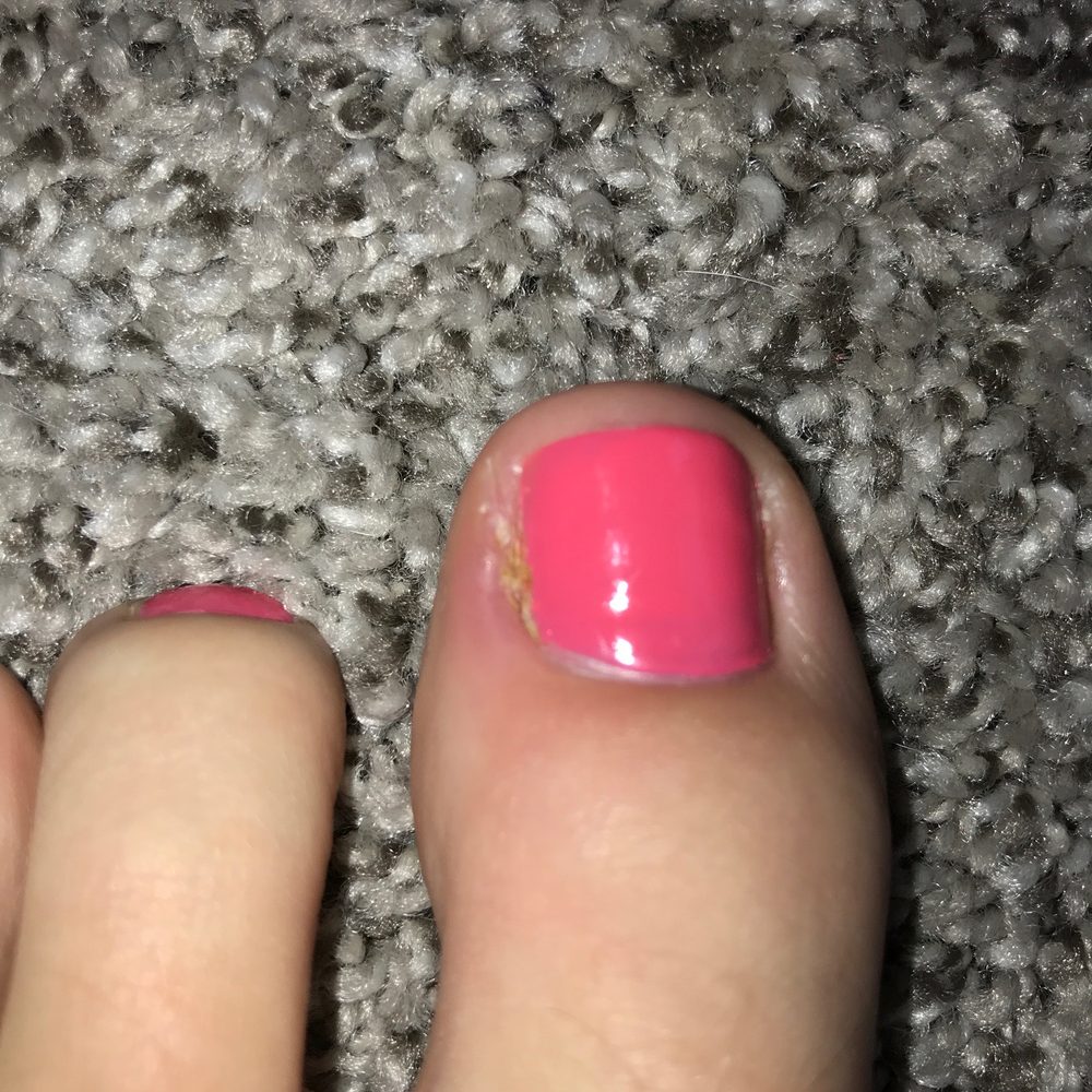 3 days after i got my toes done