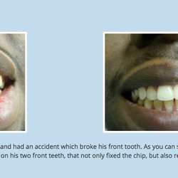 A Plus Dentistry LA