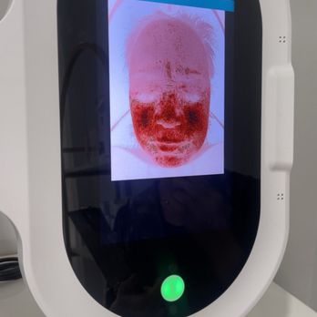 Skin So Sweet - Results of skin analysis - Skin Care Near Me - Huntington Beach, California Skin So Sweet - Results of skin analysis - Skin Care Near Me - Huntington Beach, California