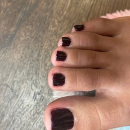 Dark colored toes Dark colored toes