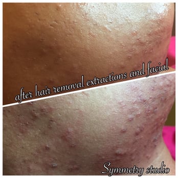 Symmetry Studio - Skin Care Near Me - Chicago, Illinois