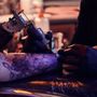 Photo of Velvet Tattoo Removal 