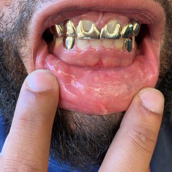 Comfort Dental - They think this is even and acceptable , - General Dentistry Near Me - Denver, Colorado Comfort Dental - They think this is even and acceptable , - General Dentistry Near Me - Denver, Colorado