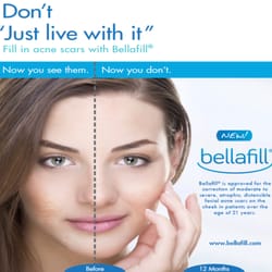 Eden Medical Spa - I personal had the Bellafill done at Eden Medical Spa and there was no down time. I left looking younger and feeling good about doing it.